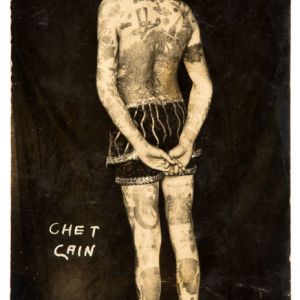 chetcainfree