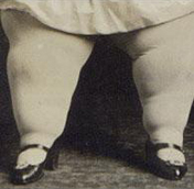 fatfolk